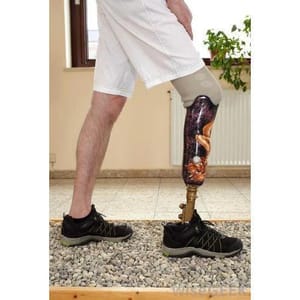 Functional Prosthetic Carbonfiber Aluminium And Ss Below Knee Artificial Leg, Thickness: 5 Mm, active use