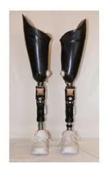 Above Knee Artificial Limbs