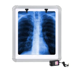 Led X Ray View Box