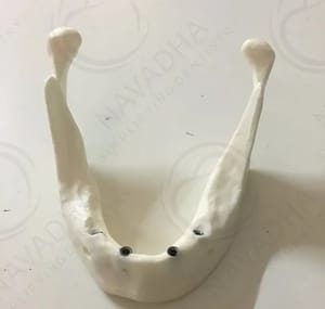 Model Of a Normal Mandible, For Dental Taining