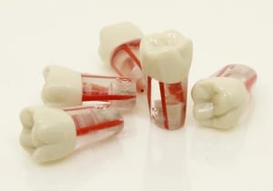 Columbia Dentoform PVR 860 Red Endodontic Typodont Tooth, For Laboratory, Model Name/Number: ADC07-3