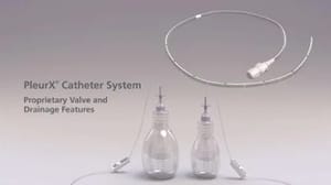 PleurX Catheter System